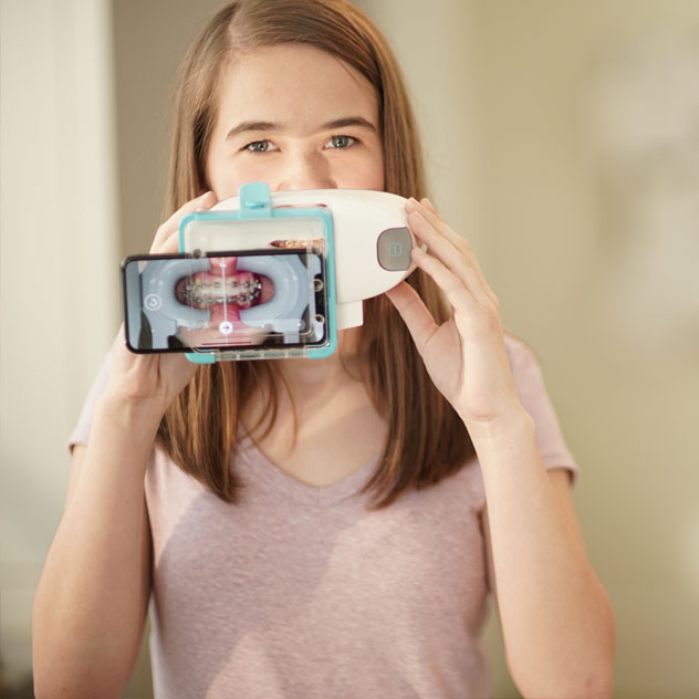 Benefits of Dental Monitoring