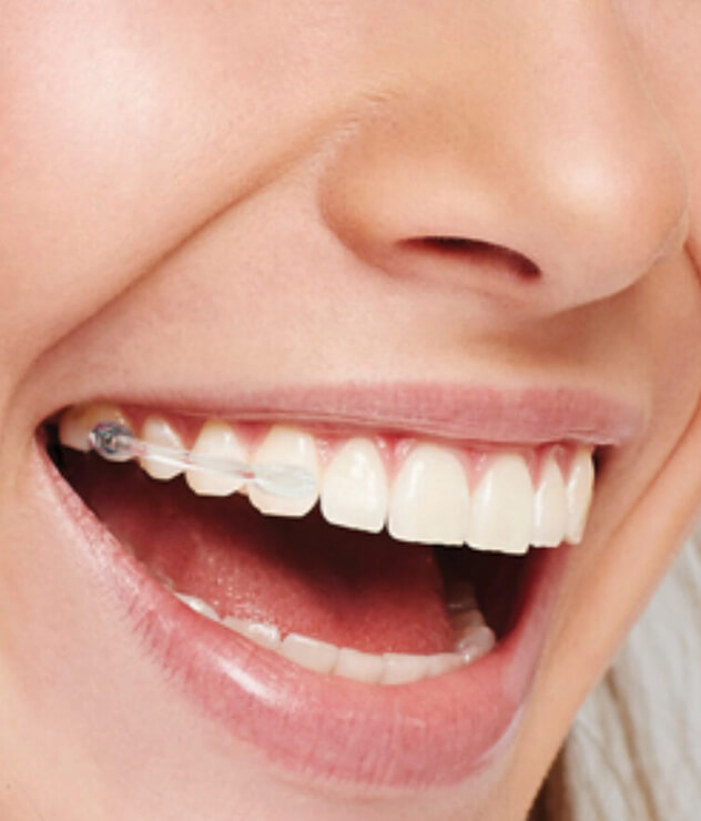 Take the first step towards a more balanced smile