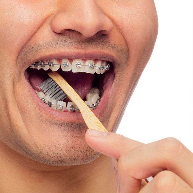 Food caught between teeth or braces