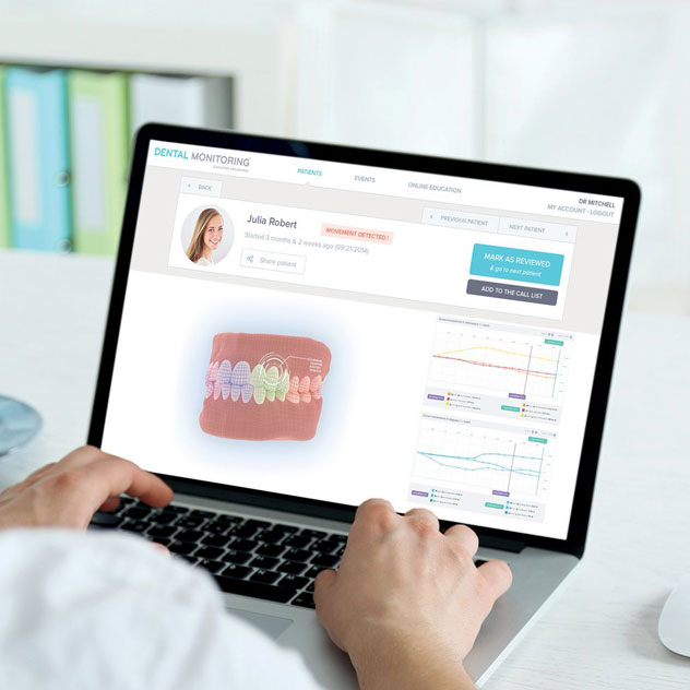 Remote Dental Monitoring