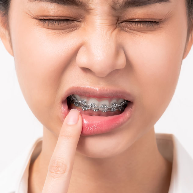 Mouth sores